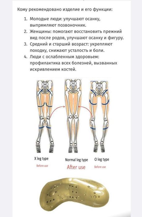 Стельки лечебные коррекционные