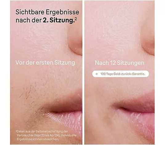 Фотоепилатор Silk-expert Pro PL5152 IPL