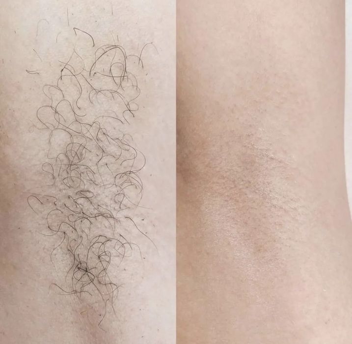 Шугаринг в Караганде по доступным ценам !!!