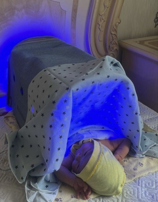 Лампа от желтушки