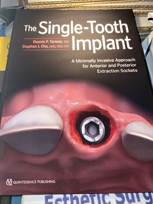 The Single-Tooth Implant J.Chu