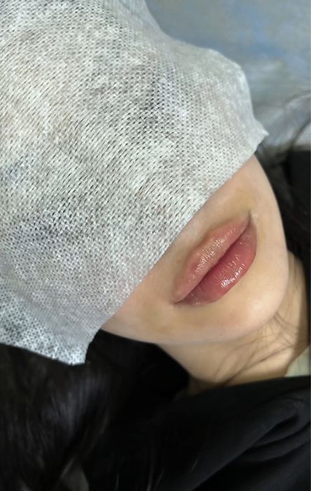 Аугмен губ 23900