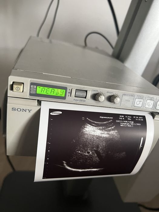Продается УЗИ аппарат