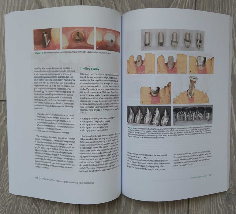 Zero Bone Loss Concepts - Tomas Linkevicius 2019