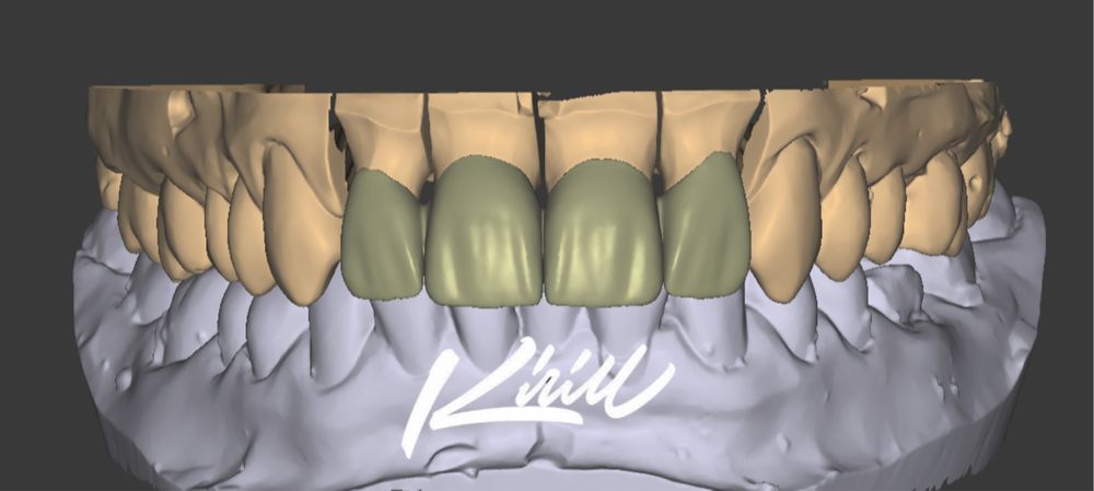 Моделирование зубов (exocad/blender)