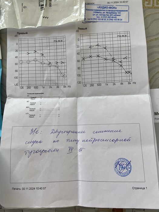 Продам слуховой аппарат