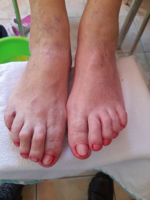 Pedichiura la domiciliu clientei.