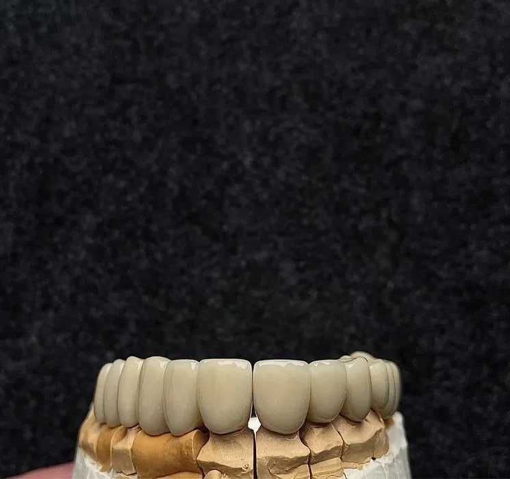 CAD/CAM – компьютерное моделирование зуботехнические услуги