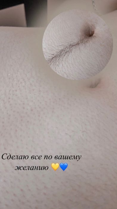 Шугаринг всего тела.