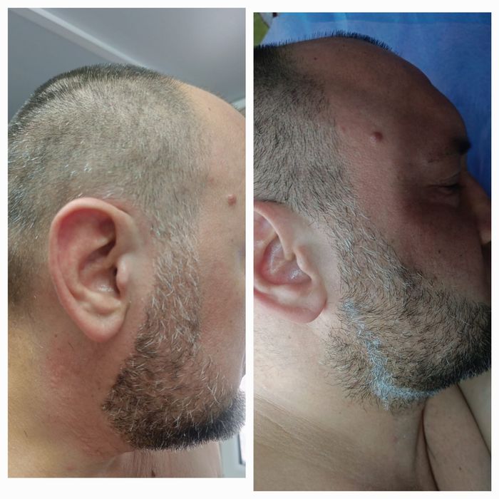 Депиляция г. АЛМАТЫ