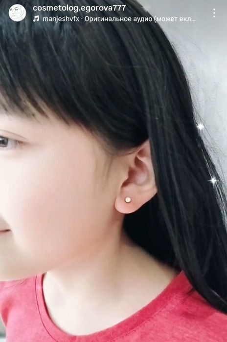 Прокалывание ушей