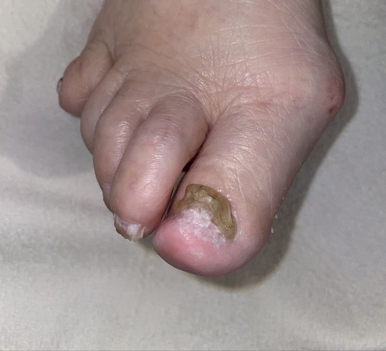 Manichiura & Pedichiura estetica / medicala