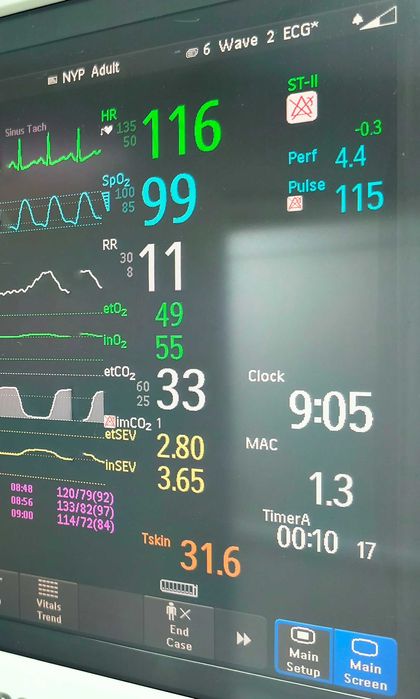 Монитор пациента Philips IntelliVue MP70 anesthesia