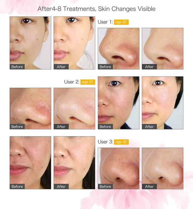 Aparat cosmetic 16 în 1 profesional pentru tratamente faciale + cadou gratuit - Încălzitor de prosoape cu sterilizator UV