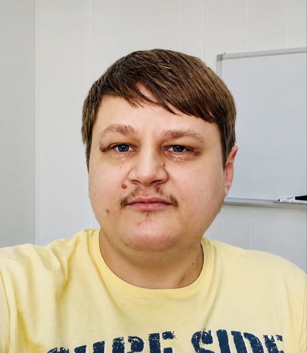 Ремонт телевизоров