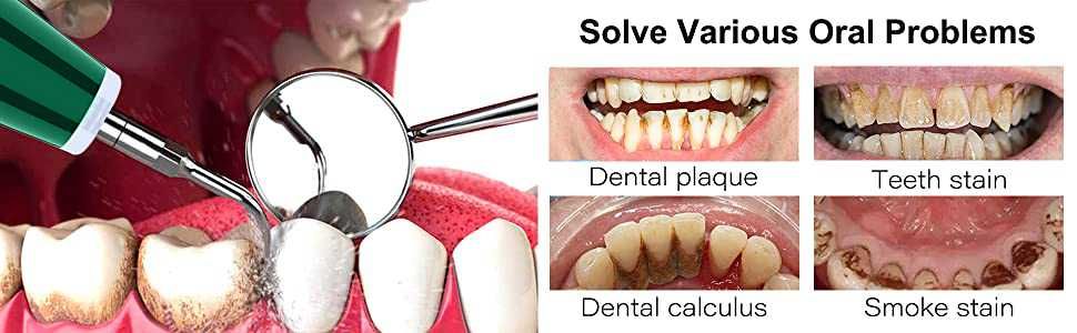 Комплект за почистване на зъби и зъбен камък LB1