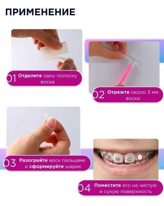 Воск для брекетов