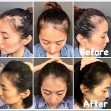 ageLOC Nutriol Scalp & Hair System