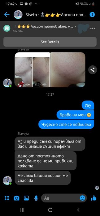 Лосион Против Акне, Мазна Кожа, Разширени Пори и Херпеси - 100мл