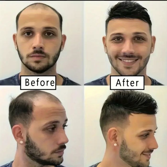 Мужские топперы из натуральных волос