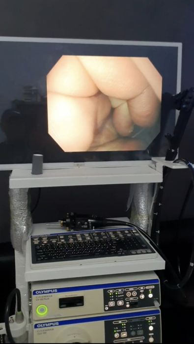 Olimpus evis exera III 190  Супер скидка