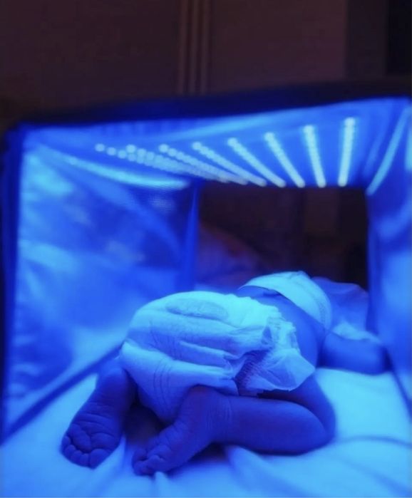 Лампа от Желтухи