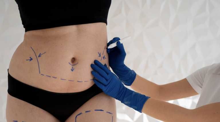 Пластични/ Козметични операции в Турция - организация, придружаване