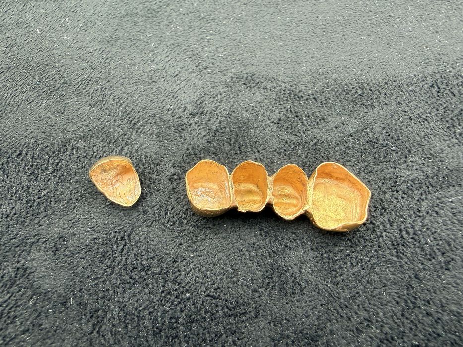 Золтые коронки 4.7 грамм 887 проба