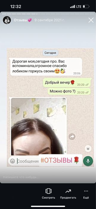 Плазмолифтинг - 7990