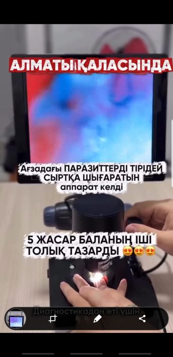 Диагностика паразитов