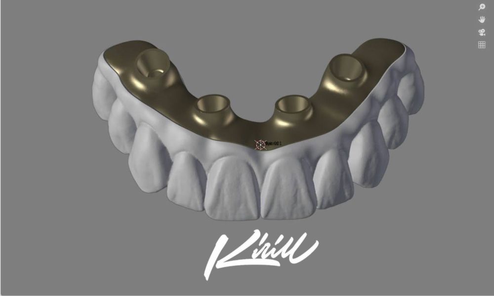 Моделирование зубов (exocad/blender)