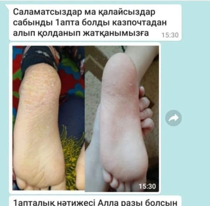 Мен саяжайда жалаңашпын. Фото.