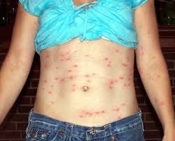 20% Скидка Дезенфекция дизенфекция дезинфекция дизинфекцияdizinfeksiya