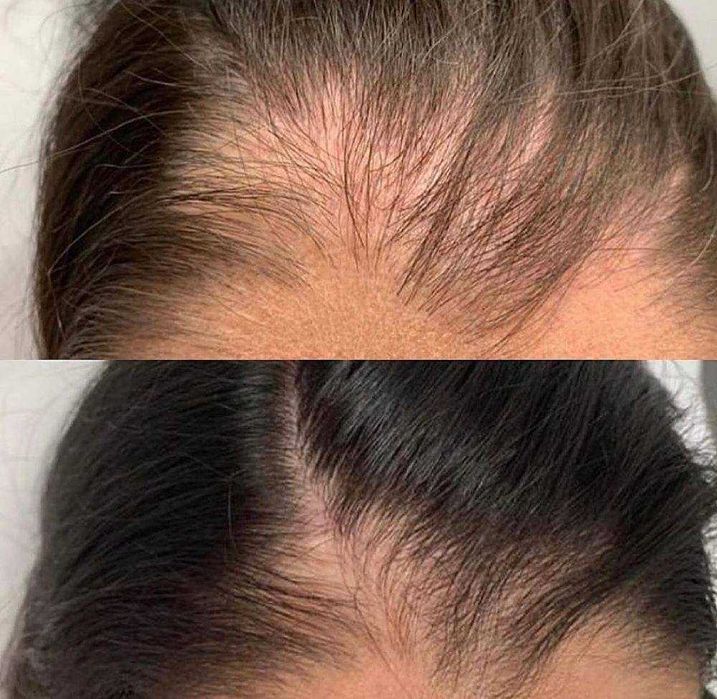 Kosmetika ayollar uchun