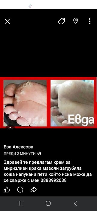 Крем за гъбички мазоли