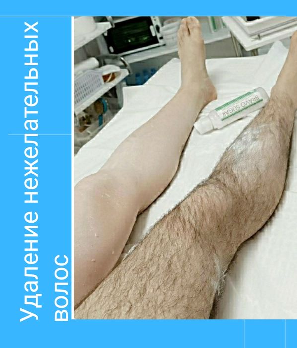 Депиляция мужчинам