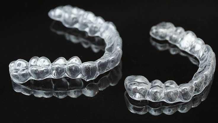 Професионална изработка на ретайнери, шини за избелване и бруксизъм