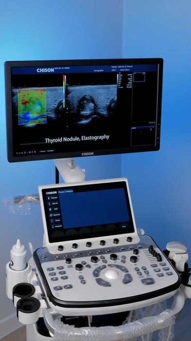УЗИ аппарат Chison Xbit 80 экспертного класса