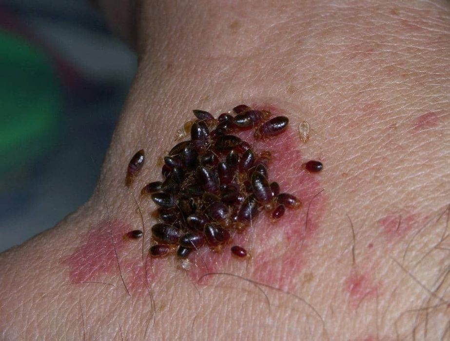 Дезинфекция. (dezinfeksiya.) Zararkunanda kalamush. sichqon.xashoratla