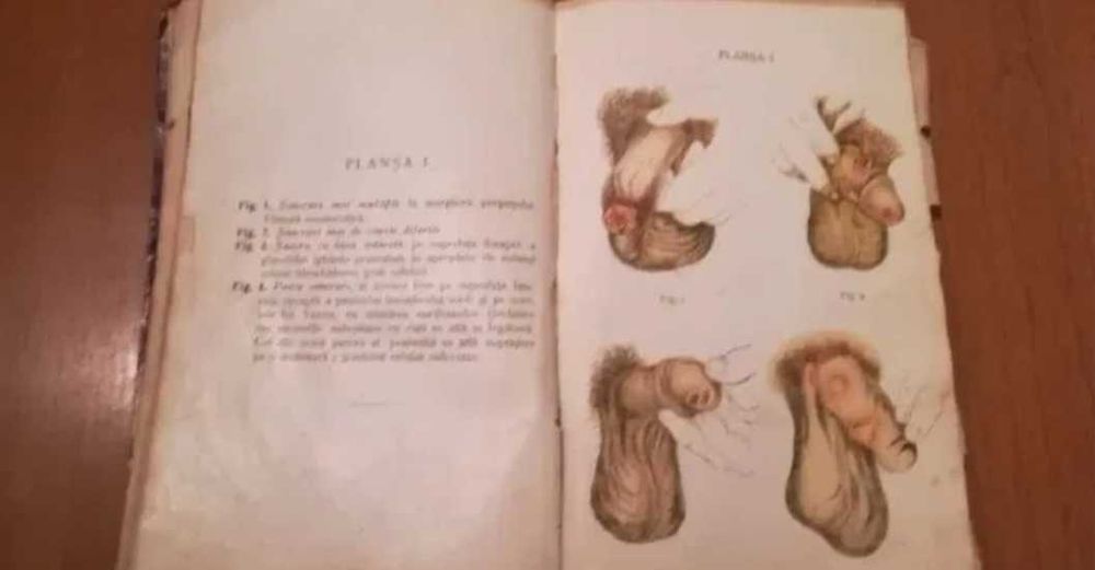 Carte  Instinctul sexual 1921, Dr iosif westfried