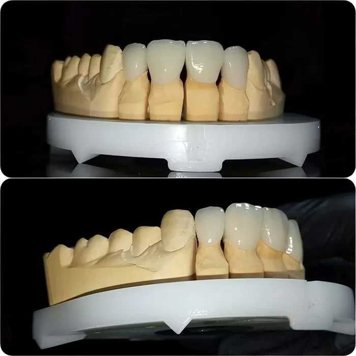 Зуботехническая CAD/CAM услуги в стоматологии