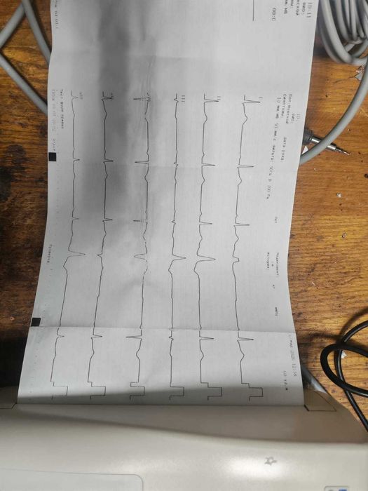 Электрокардиограф
