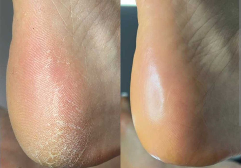 55 Lei Ofer sercivii de cosmetizare calcaie si pedichiura cosmetica  la domiciliul clientei - Bucuresti
