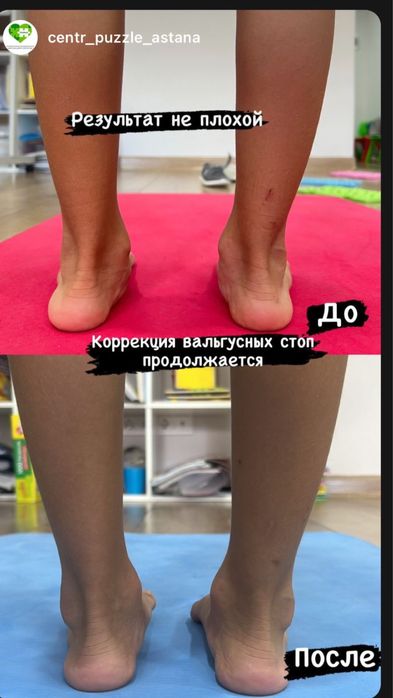 Логопед дефектолог! ЛФК, АФК тренер!