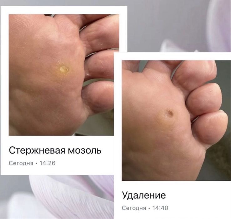 Педикюр на выезд