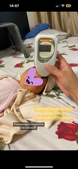 Аренда лампа от желтушки. Билитест. Все виды!