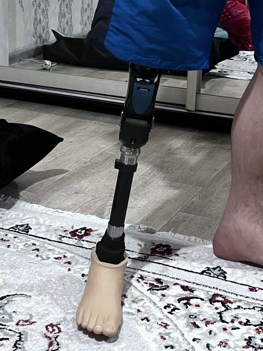 Протез бедра новый
