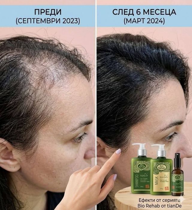 Мечтаеш ли за гъста и здрава коса? 
Край на косопада с интензивната с