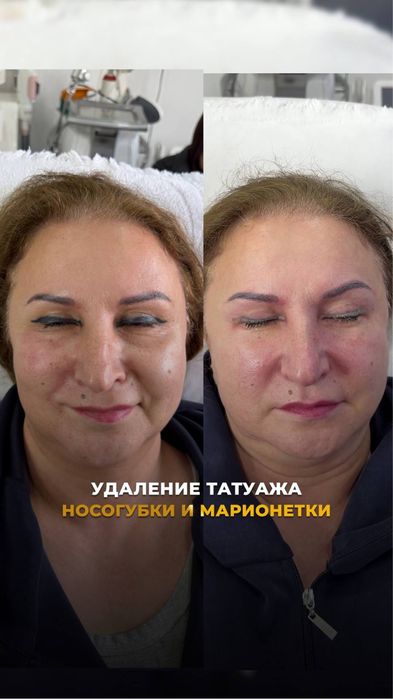 Услуги косметолога
