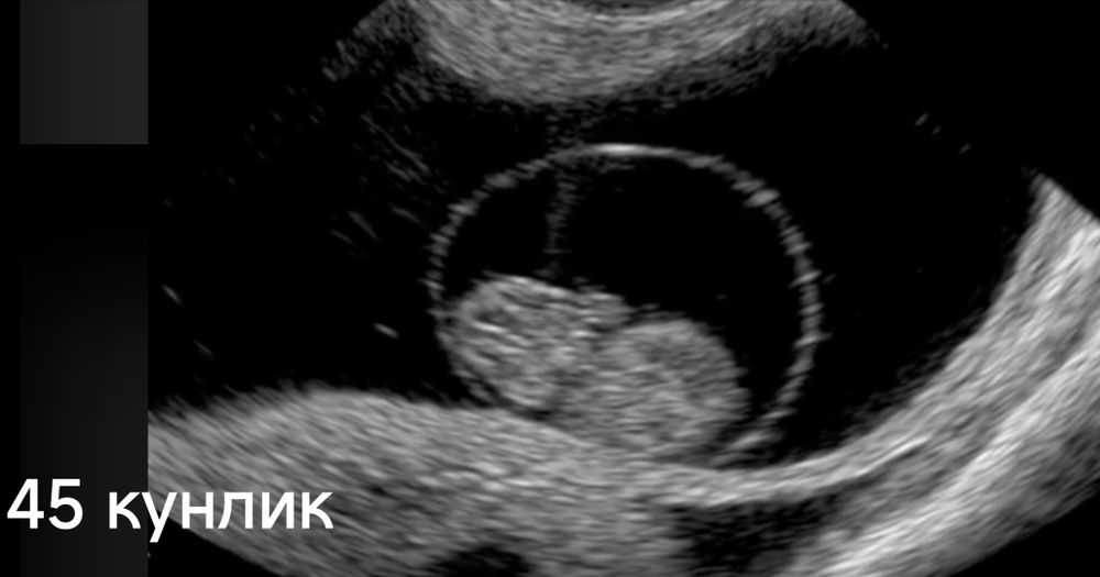 Узи диагностика хизмети